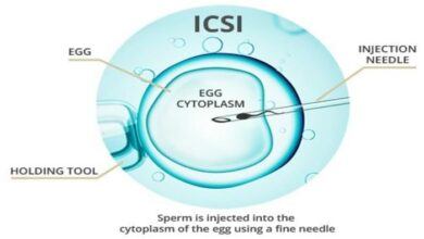 intracytoplasmic-sperm-injection-icsi-procedure-featured-image_700x400 (1)