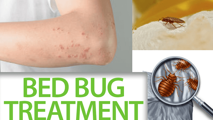 Bed Bug Treatment